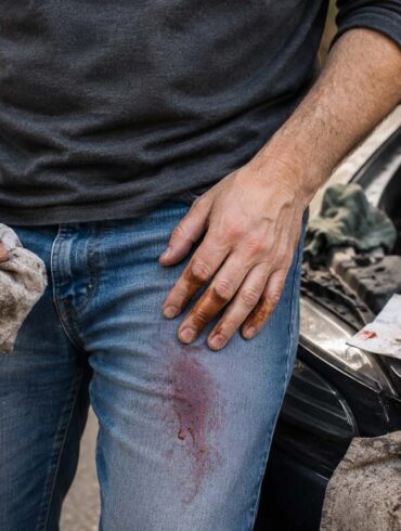 A man works on a car in a driveway with reddish transmission fluid staining the thigh of his blue jeans, while his oily hands, a used rag, and an unbranded bottle of transmission fluid are visible beside the open hood.
